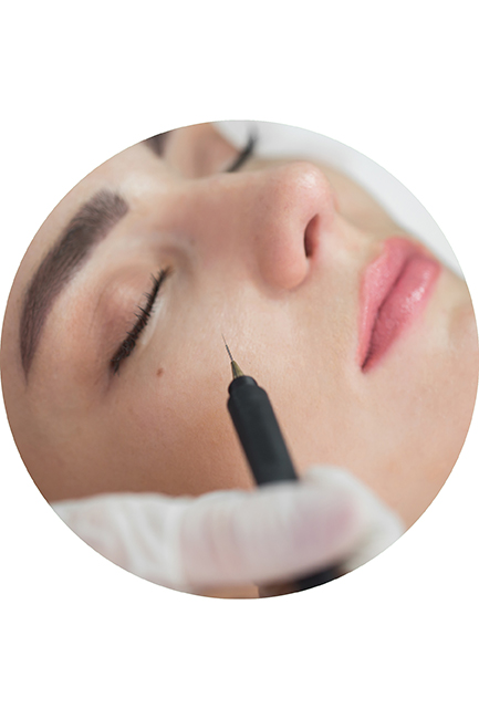 Aesthetic Needles & Cartridges