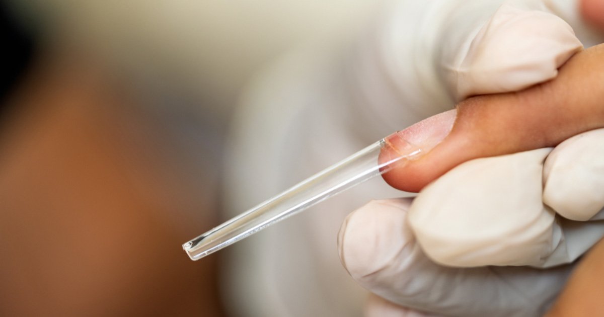 A close-up view of a clear plastic nail extension being applied to a natural fingernail by a person wearing white gloves.