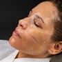Bio-Therapeutic Hyaluronic Delivery Face Masque 10pkAlternative Image5